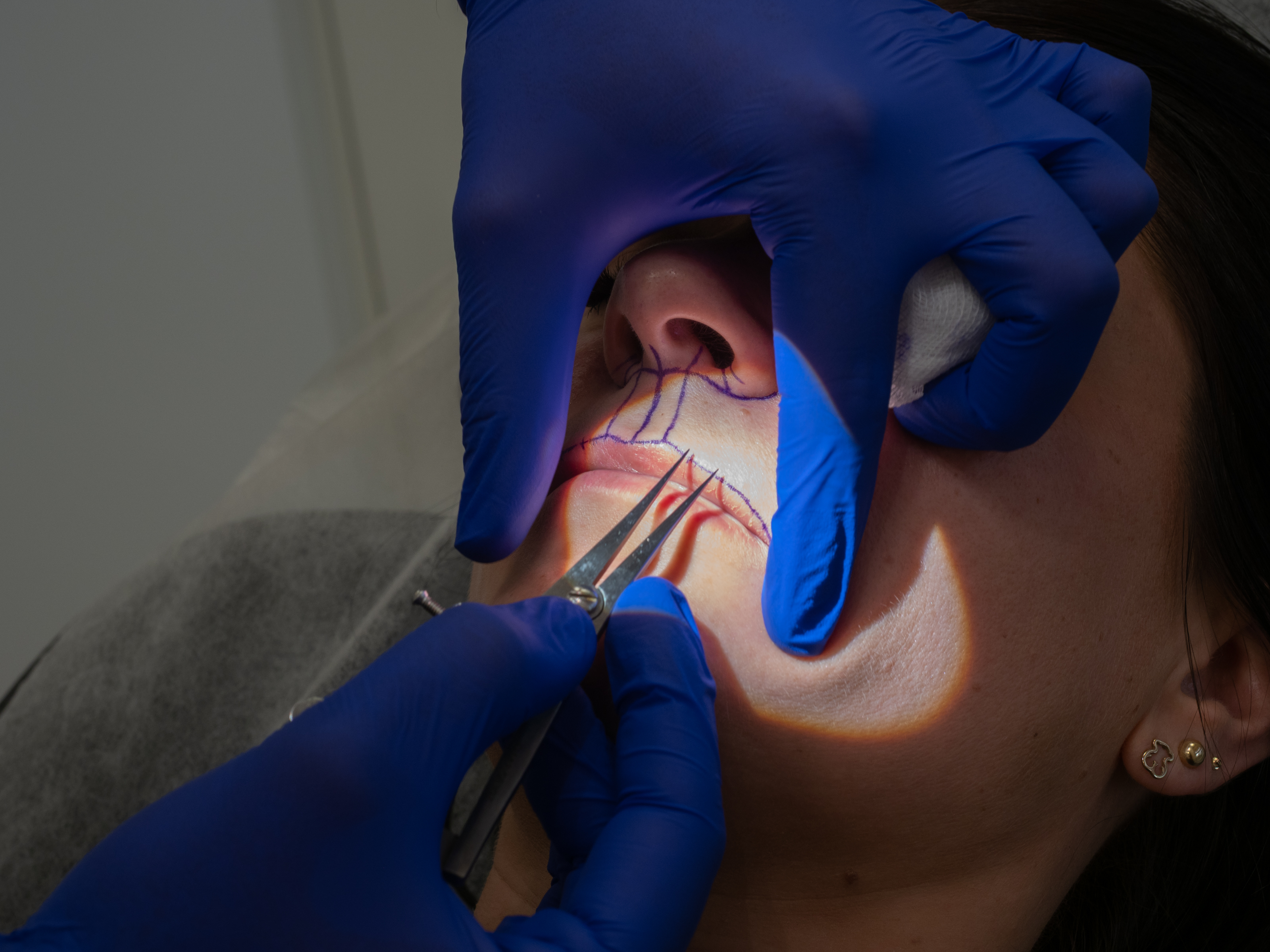 Precyzja Chirurgiczna